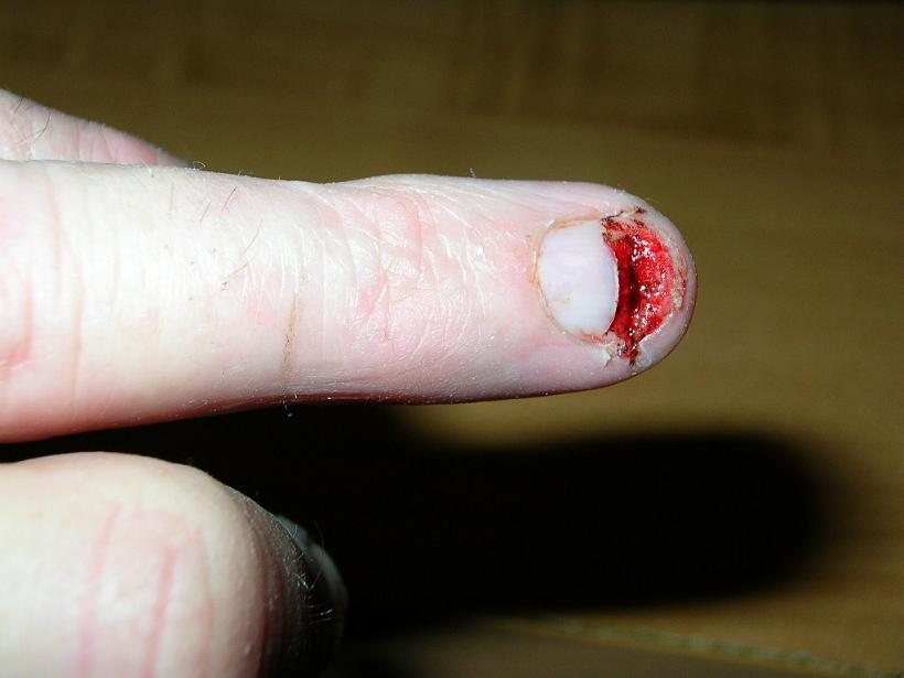 200865141029_finger%20vs%20tablesaw%20blade.jpg