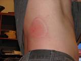 tn_IMG_0176b.jpg