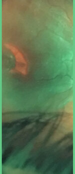 Vertex3.jpg