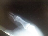 finger.jpg
