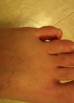 toe.jpg