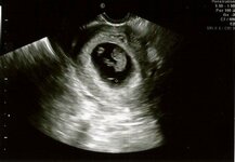 Baby Brooks 1.jpg