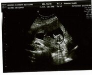 Baby Brooks.jpg