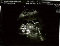 Baby Brooks 1.jpg