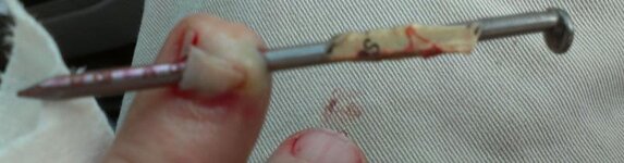 Nail in the finger.jpg