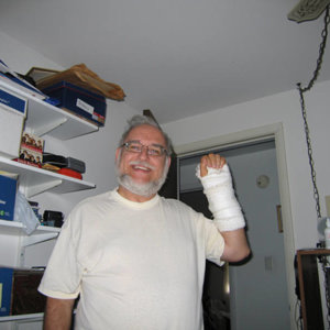 Me after surgery