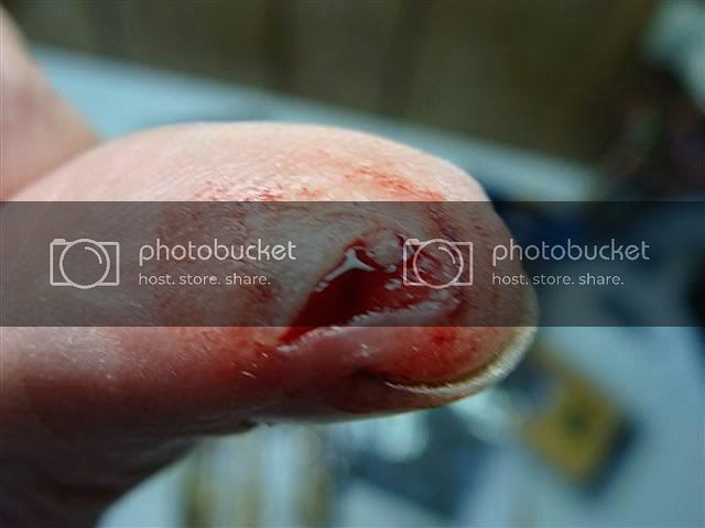 Cutthumbfromgougetutning.jpg